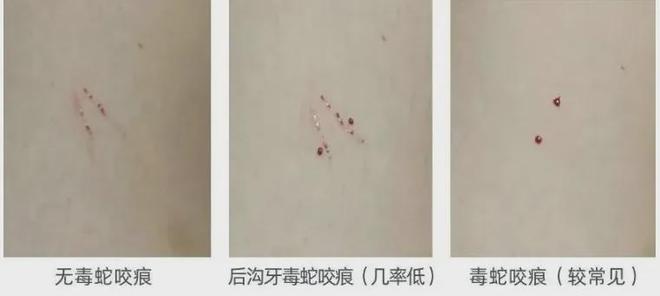 提醒：深圳近期接诊9例！网友吓坏九游会j9登录公园再次惊现！紧急(图2)